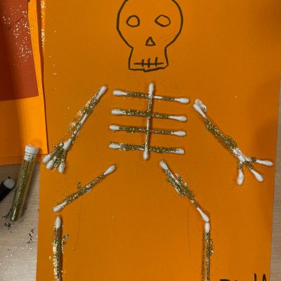 Halloween au CHU de Montpellier